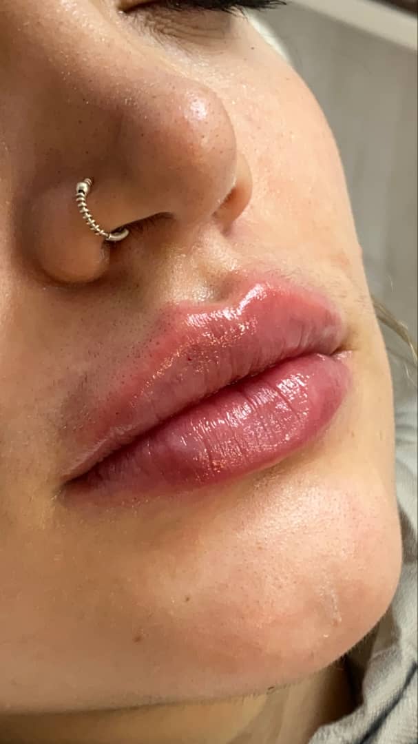 کلینیک زیبایی مرکز لیزر و لاغری زرین ماه