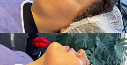 كلينيک پوست مو زيبايى و لیزر وينا