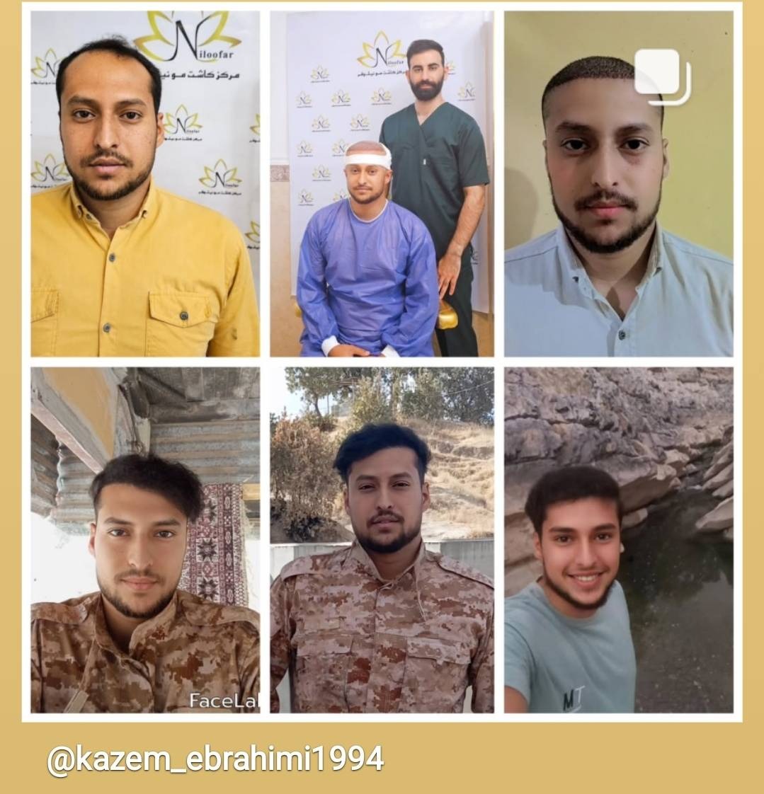 مرکز کاشت مو نیلوفر ( اندیمشک و دزفول )