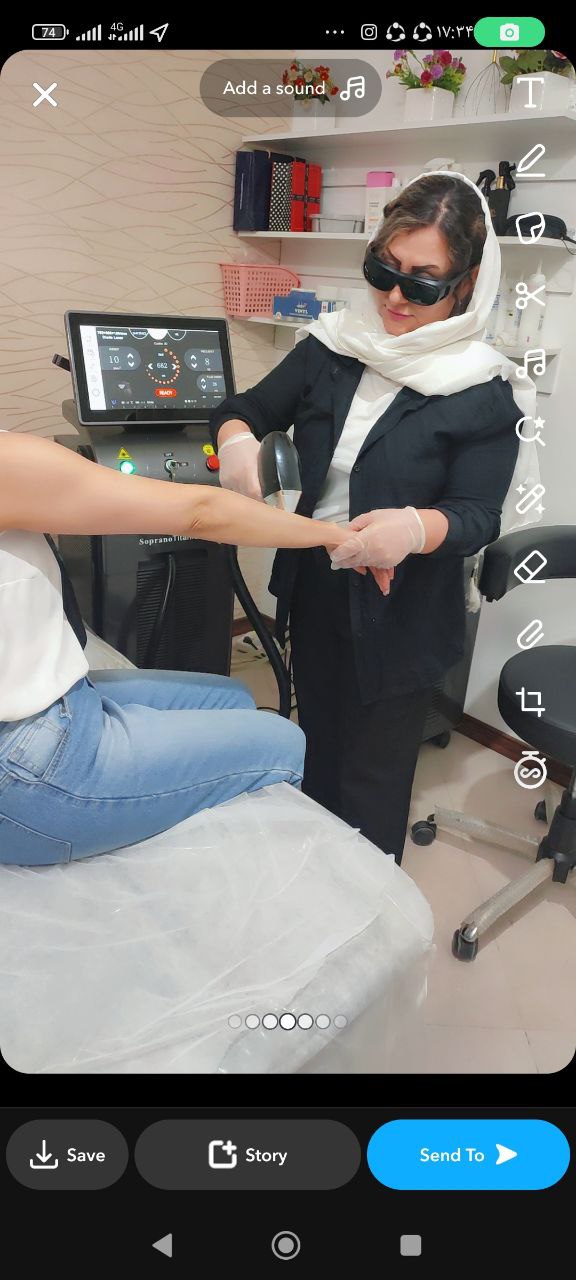 فیشیال ولیزر سیاوشی