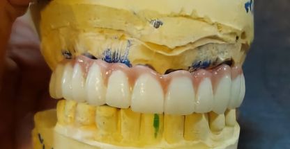 دندانسازی عابدی