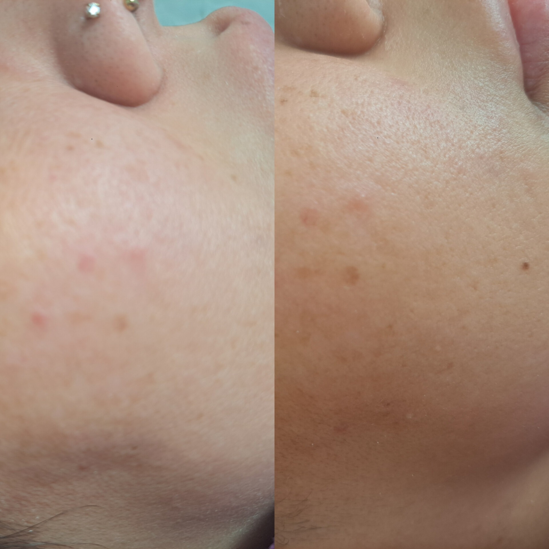 خدمات تخصصی پوست همتا