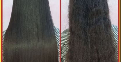 گیسونایس ده سال سابقه ی احیای مو