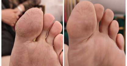 پدیکور آدری