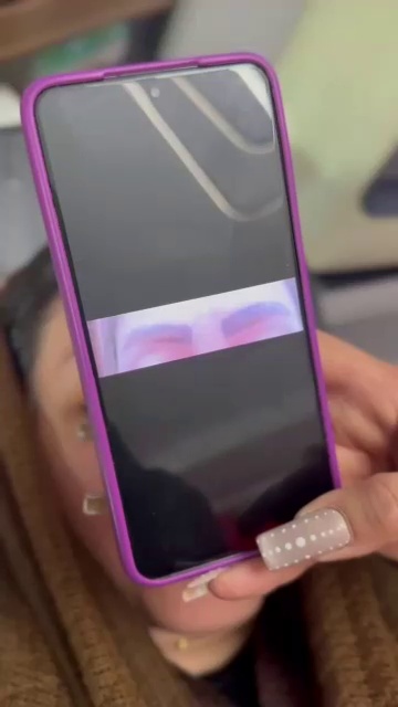 ریموو تتو بنفشه