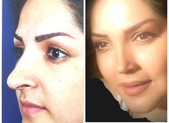 دکتر عیسی عبدی