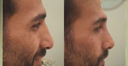 کلینیک پوست مو زیبایی راوک