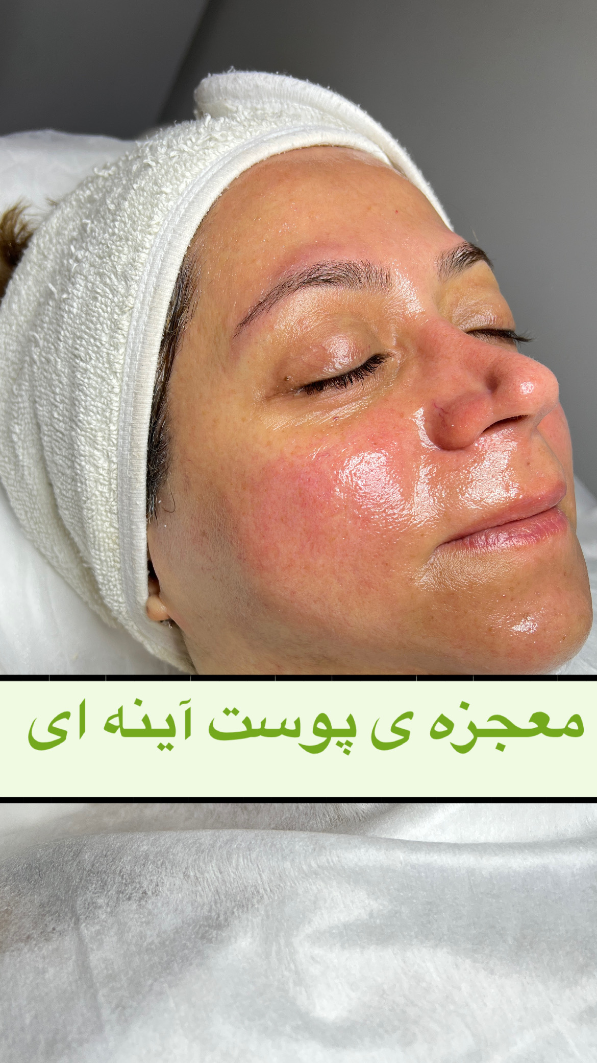 مرکز پوست و مو و زیبایی(ریلکسی) گلارین