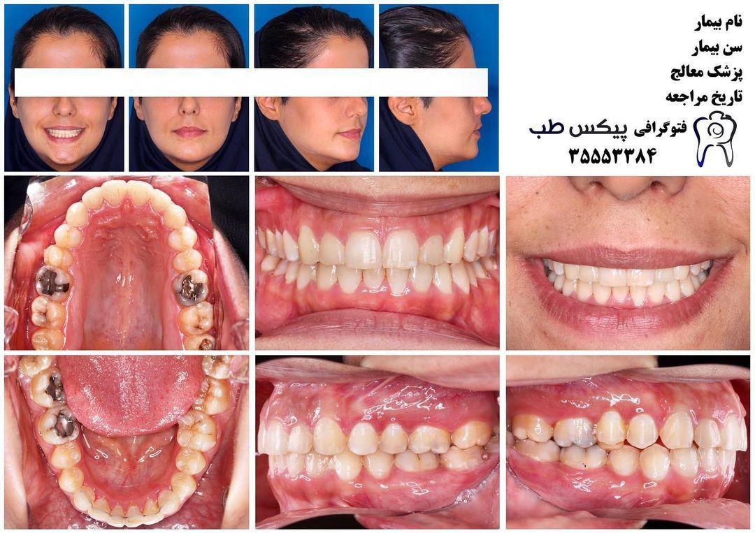 فتوگرافی پزشکی پیکس طب