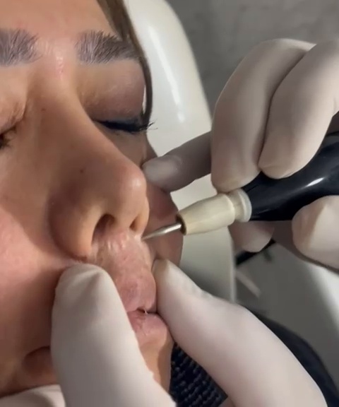مركز ليزر و مطب زيبايی دكتر محمودآبادی