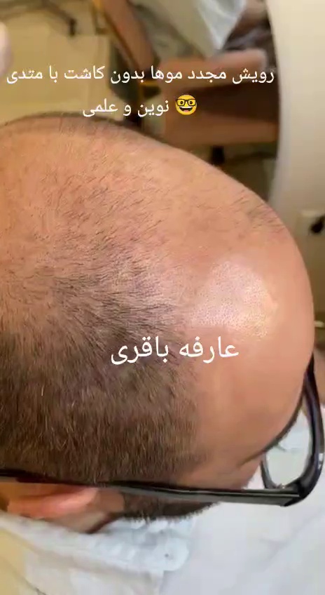 مرکز تخصصی اسکالپ تراپی (عارفه باقری)