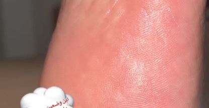 کاشت ناخن سپیده نظرزاده