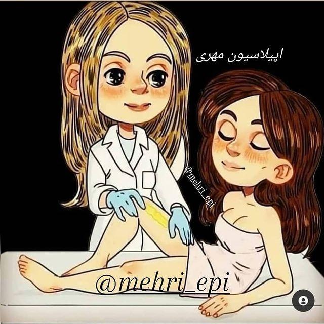 اپیلاسیون مهری