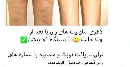 مرکز تغذیه و رژیم درمانی و لاغری