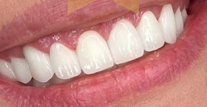 کلینیک دندان پزشکی "پلاتینیوم اسمایل"