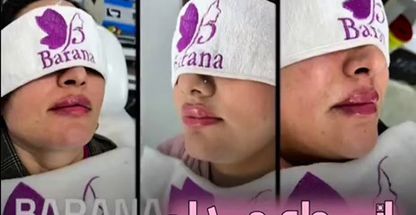 کلینیک زیبایی و مرکز لیزر بارانا