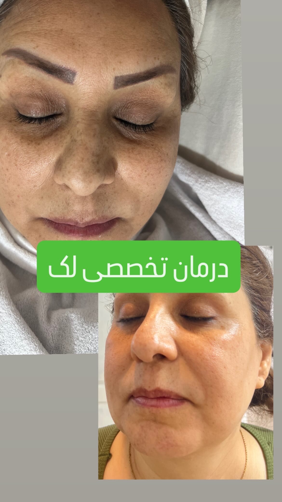 مرکز تخصصی پوست ملیکا