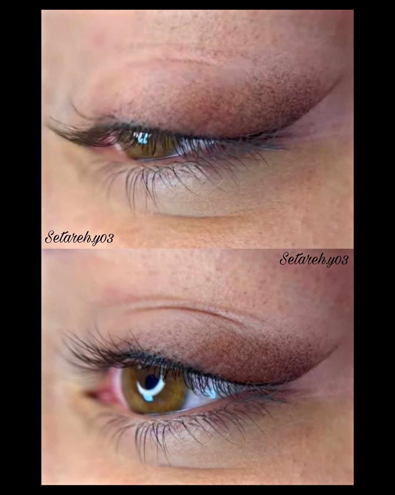 خدمات تخصصی تاتوی صورت ستاره