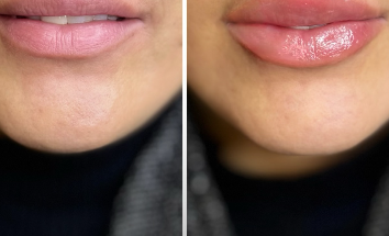 کلینیک زیبایی ملل