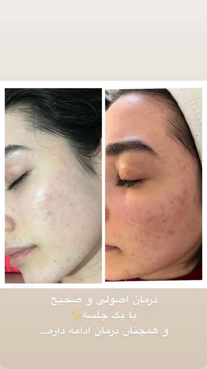 کلینیک زیبایی پوست ومو ولیزر پرمیس