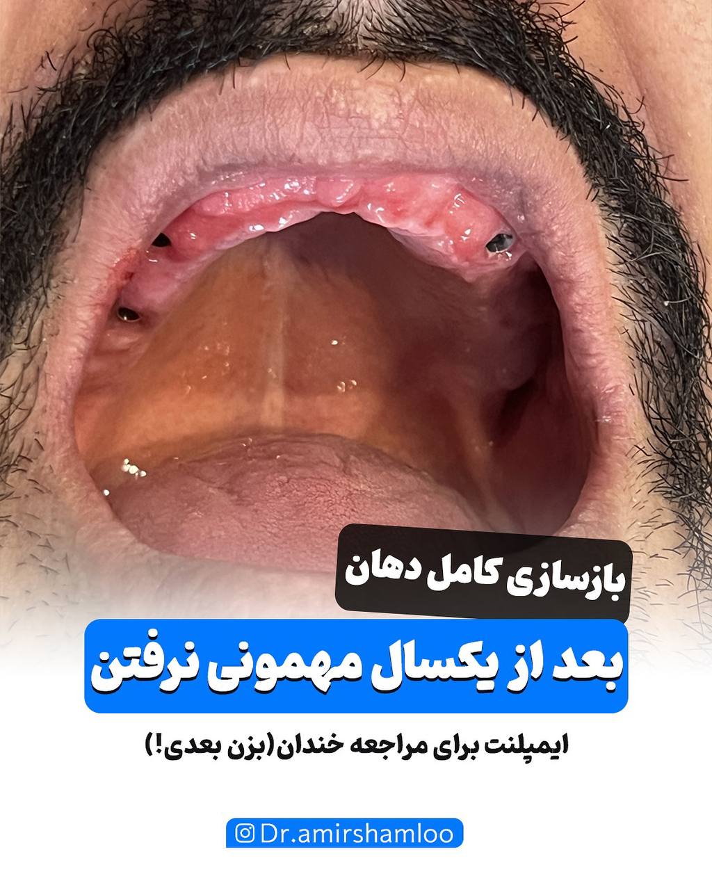 کلینیک دندانپزشکی ترکمنستان