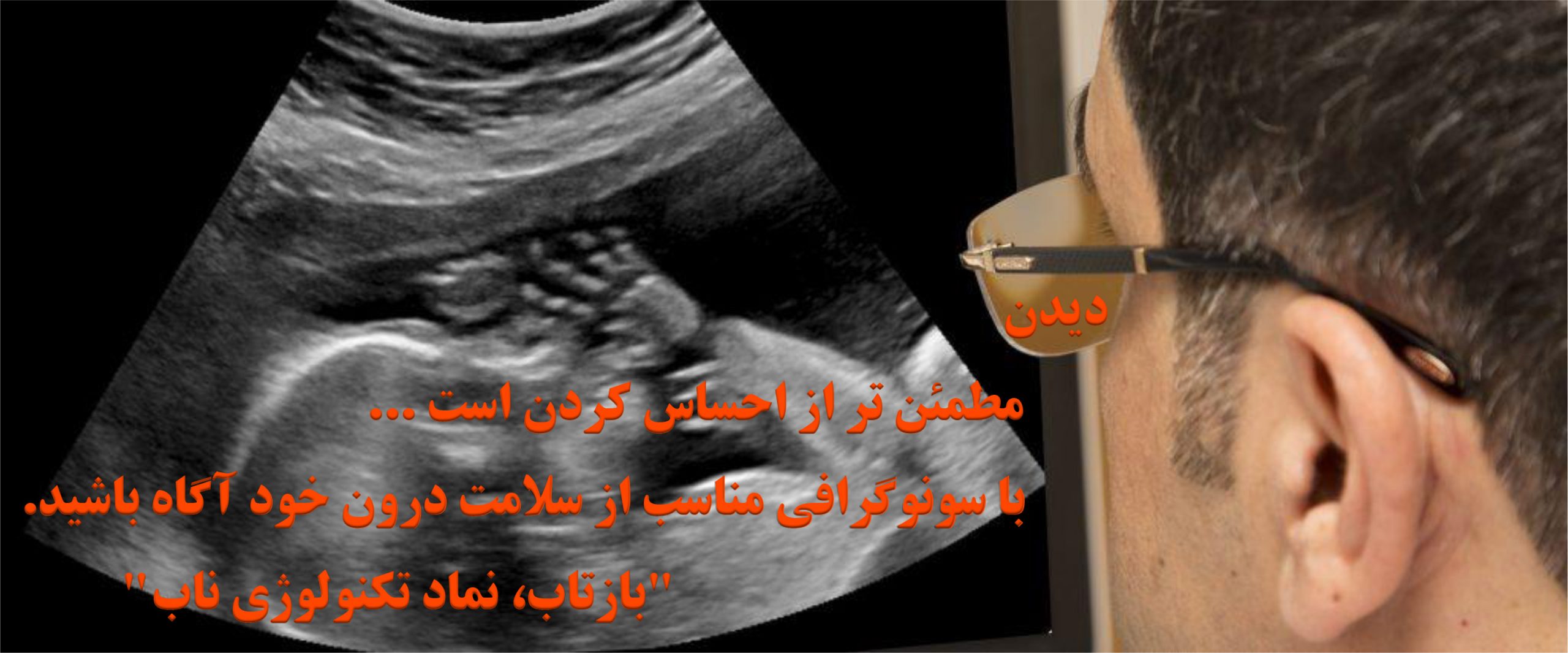 سونوگرافی، رادیولوژی دیجیتال بازتاب
