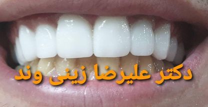 دندانپزشکی دکتر زینی وند