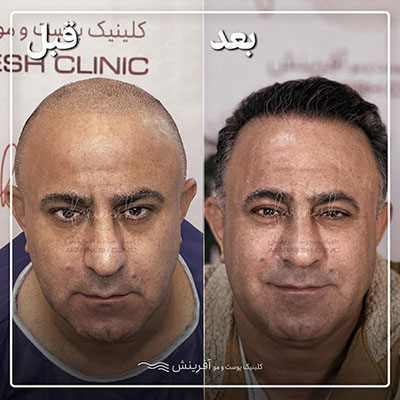 کلینیک آفرینش کاشت