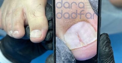 کلینیک خدمات ناخن آقایان دارا دادفر