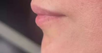 مرکز لیزر و کلینیک زیبایی پارسا