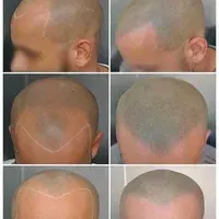 درمانگاه تخصصی پوست و مو نیتا