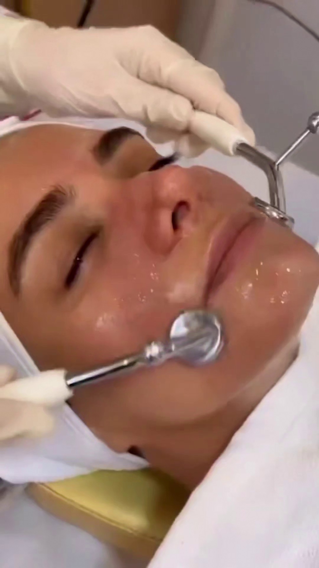 اسکین تراپیست فشیال