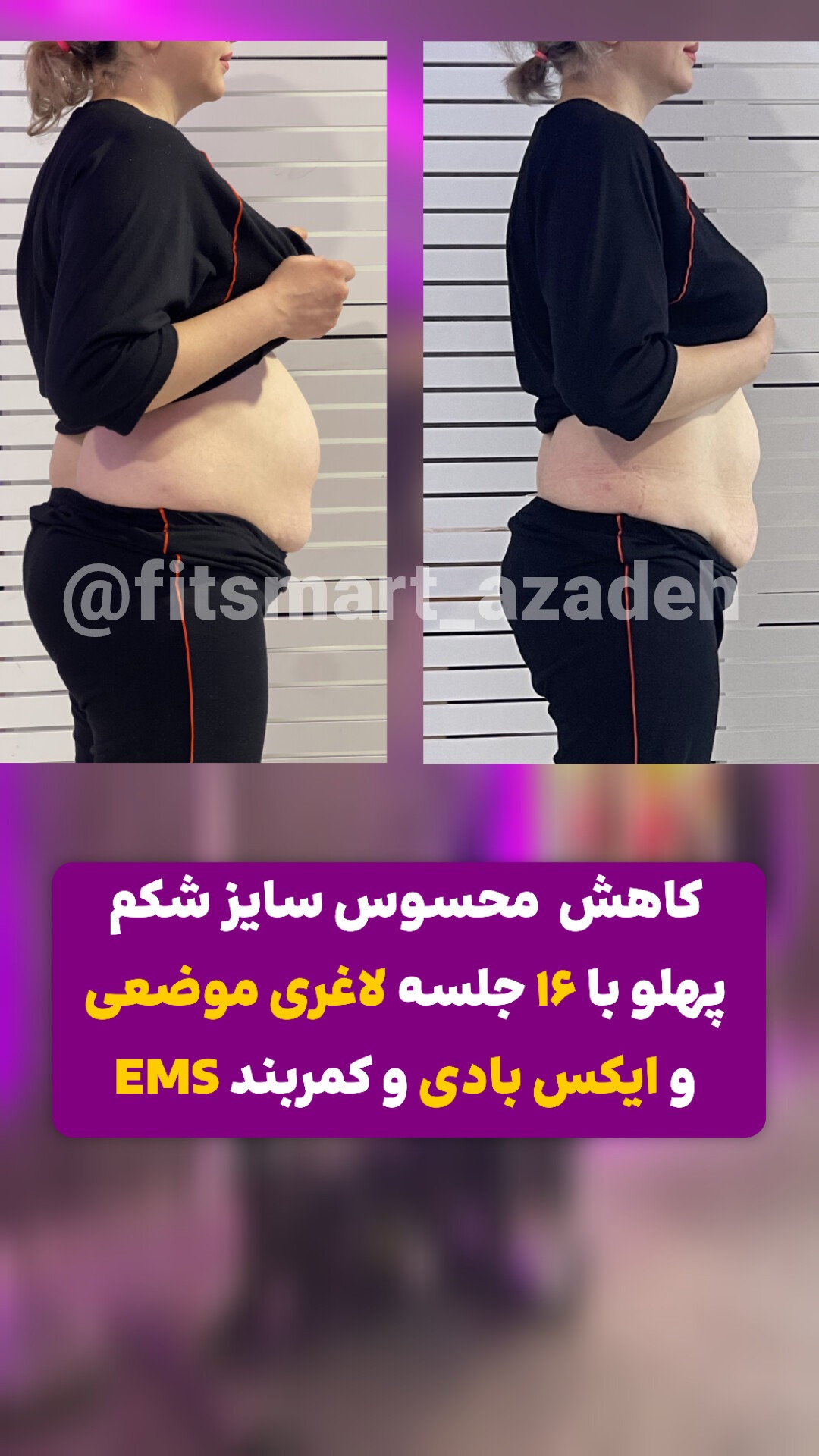 مرکز لاغری موضعی و ایکس بادی فیت اسمارت