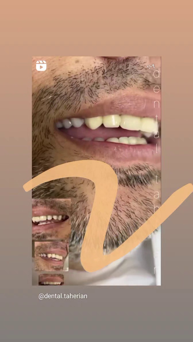 دندانسازی تخصصی طاهریان