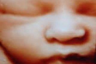 سونوگرافی و رادیولوژی دکتر مریم ابراهیمی