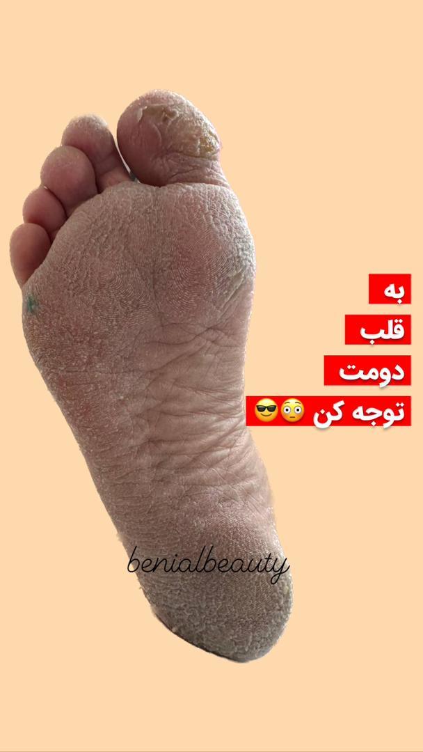 خدمات ناخن بهنوش