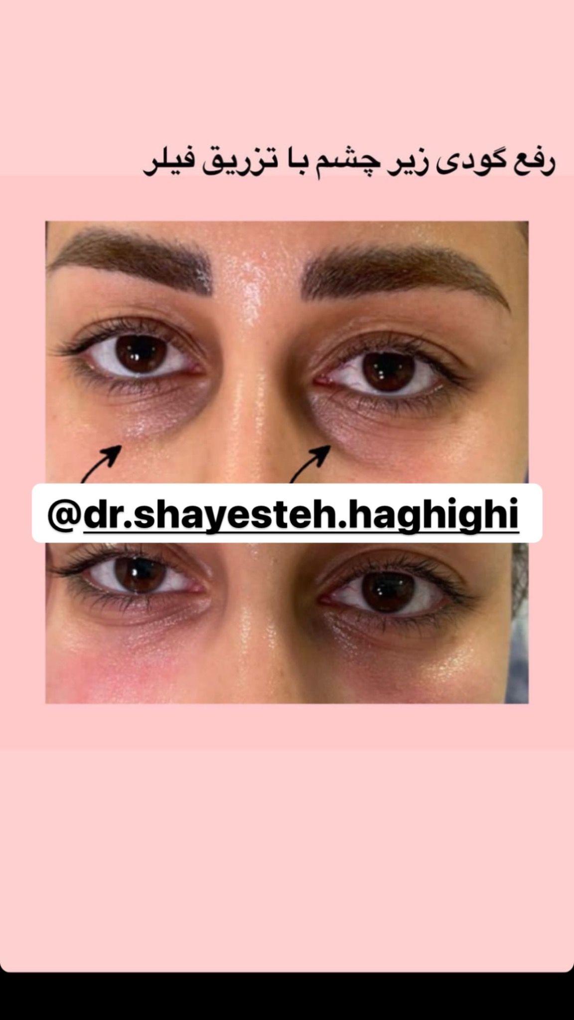 مطب پوست و لیزر