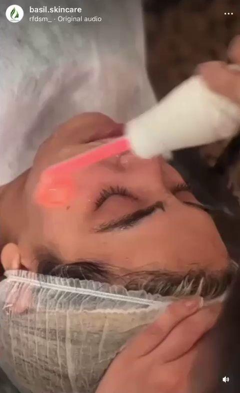 فشیال و پاکسازی پوست ریحان اسکین کر