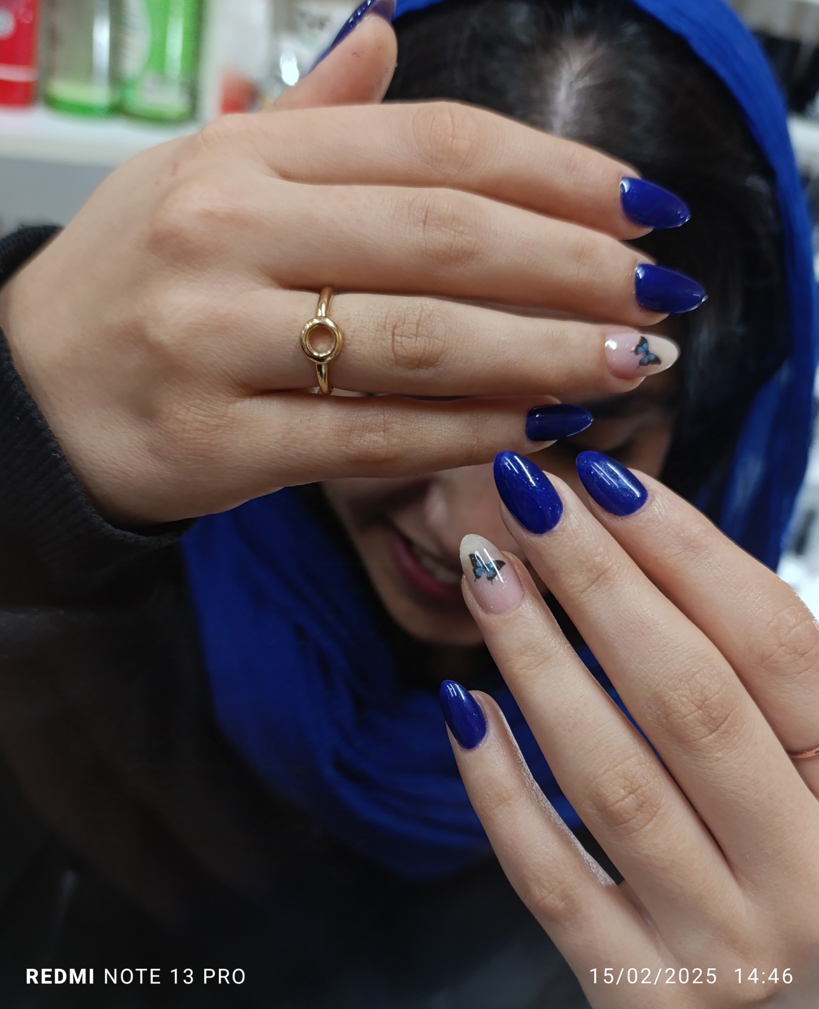 کاشت ناخن پلطالشان