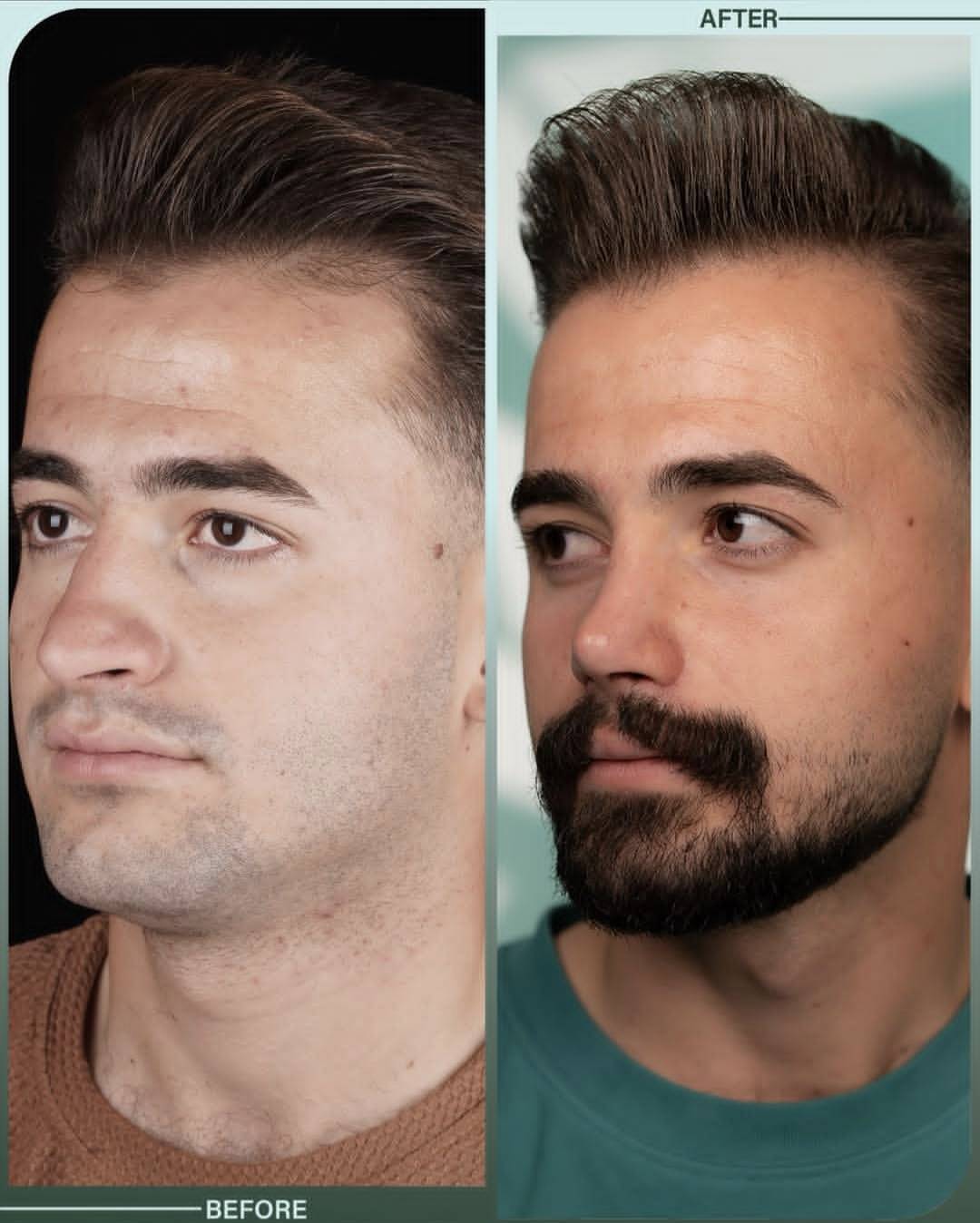 دکتر فرهاد محرابی سی سخت