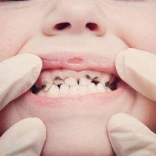 دکتر الهام حاتم زاده - متخصص دندانپزشکی کودک و نوجوان