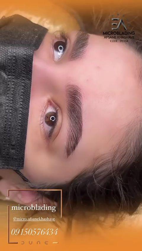 مرکز تخصصی میکروبلیدینگ ،میکروپیگمنتیشن