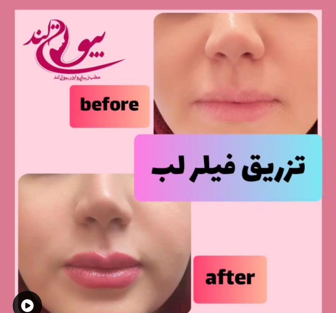 مجموعه پوست مو زیبایی بیوتی لند شریعتی