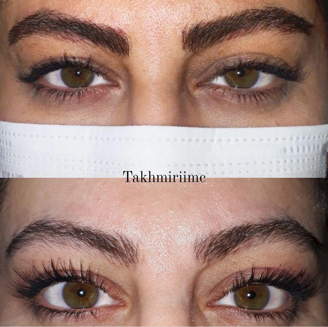 میکروبلیدینگ ابرو در گلبهار و مشهد