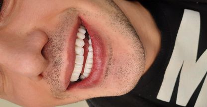 مرکز دندانپزشکی و دنداسازی نکو