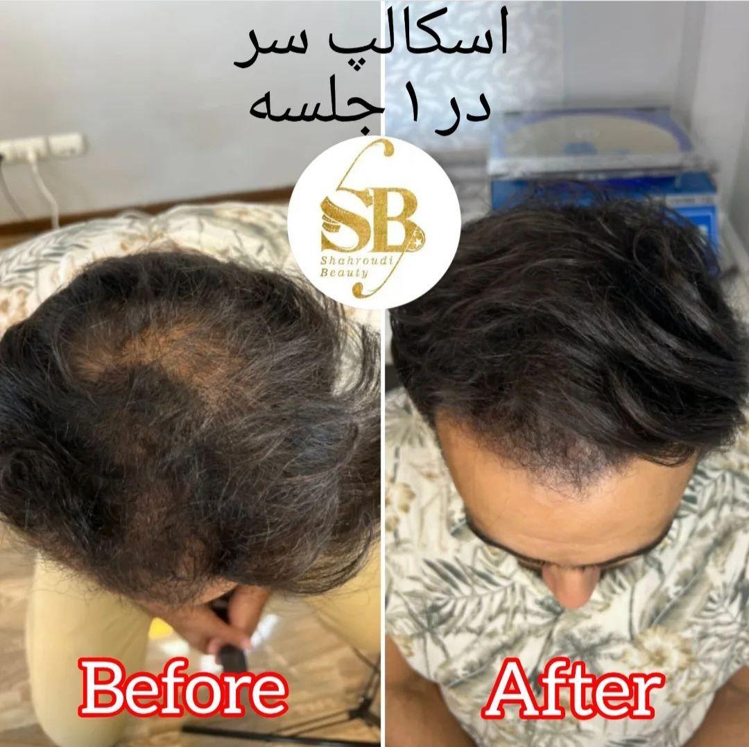 مرکز زیبایی پوست ، مو و لیزر