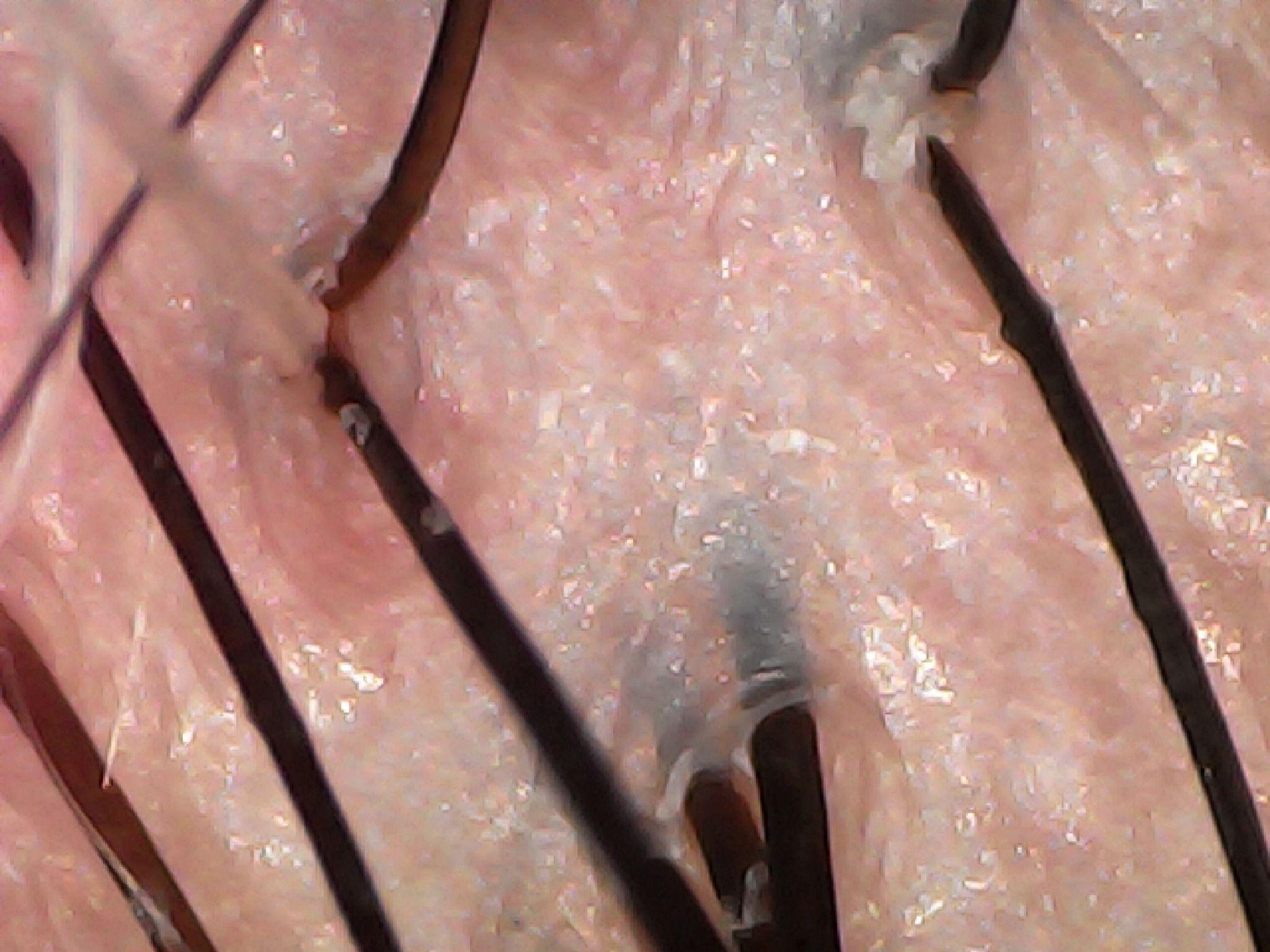 احیا صافی و اسکراب اسکالپ