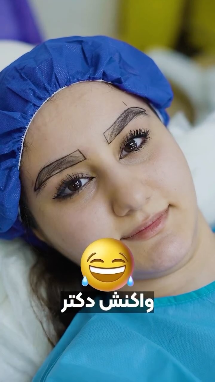 کاشت مو و ابروی لیما