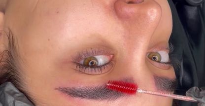 مرکز تخصصی میکروبلیدینگ و ریموو تتو زهرا