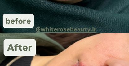 کلینیک زیبایی رز سفید